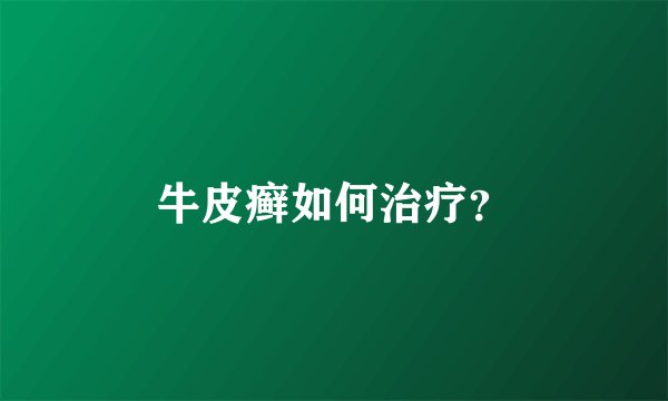 牛皮癣如何治疗？