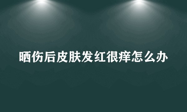 晒伤后皮肤发红很痒怎么办