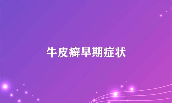 牛皮癣早期症状