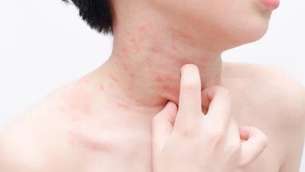 相关推荐