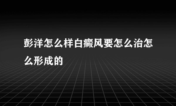 彭洋怎么样白癜风要怎么治怎么形成的