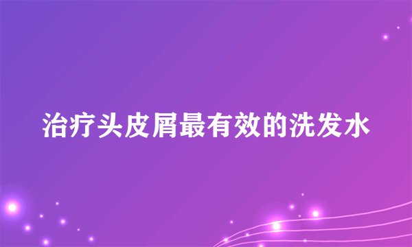 治疗头皮屑最有效的洗发水