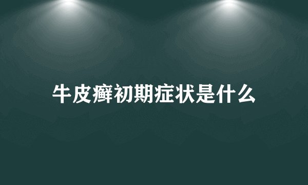 牛皮癣初期症状是什么