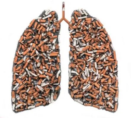 肺间质纤维化自己能好吗 这些方法可治肺间质纤维化