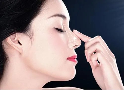 上海鼻子整形多少钱