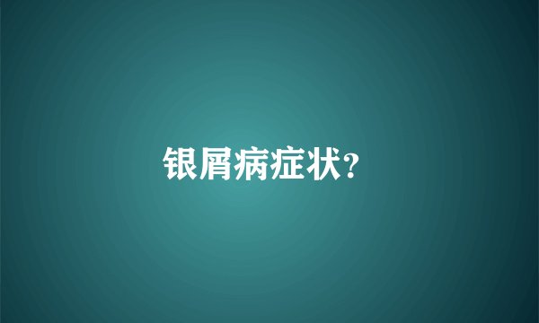 银屑病症状?