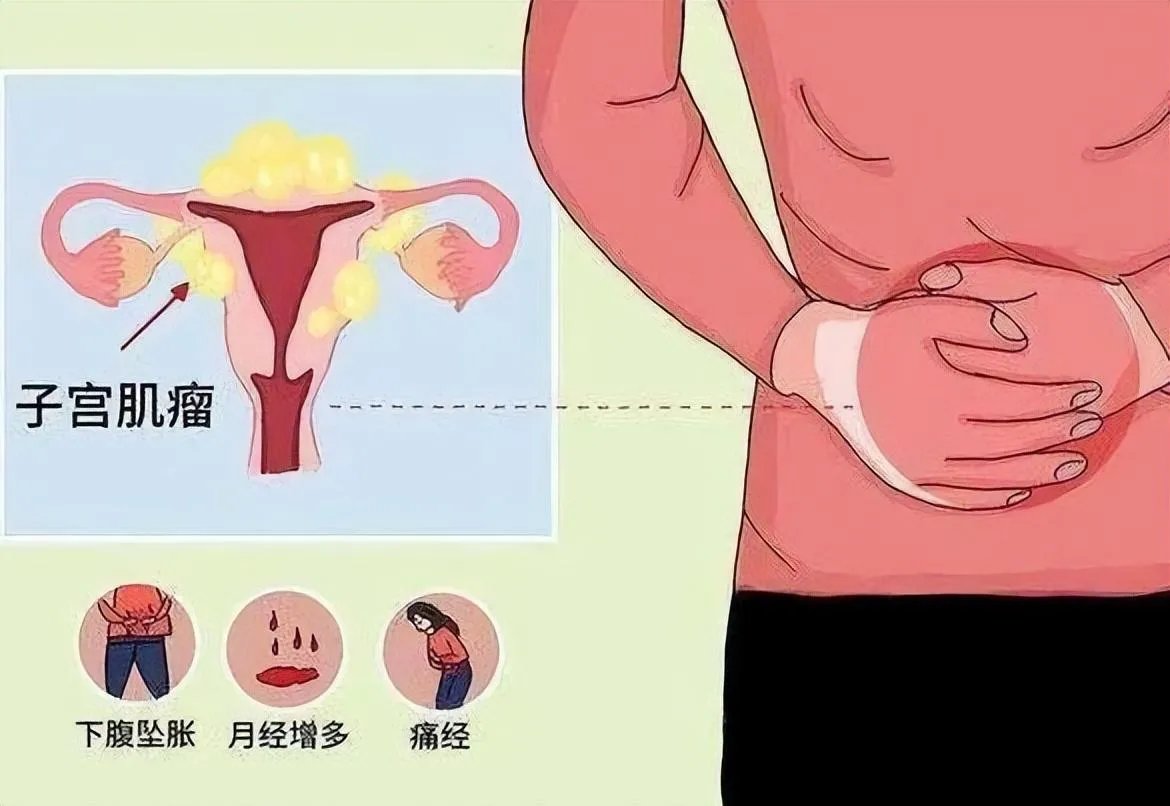国内能供应卵子的公立三甲医院-汨罗不孕不育最好的生殖医院在哪里?