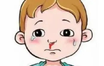 河南通报儿童流鼻血,目前医生的诊断结果是什么?