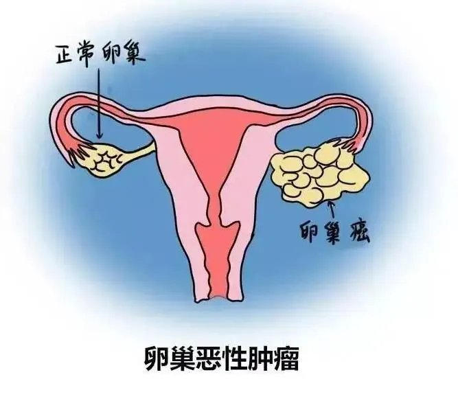 供卵试管费用明细-2023年厦门捐精试管多少钱？试管费用详细参考