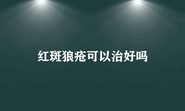 红斑狼疮可以治好吗