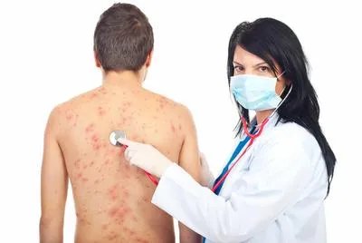 背上长痘痘怎么办 盘点6个消除背上痘痘的方法